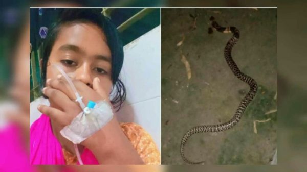 তাড়াশে সাপ কামড় দেয়ার পর সাপকে নিয়ে টিকটক