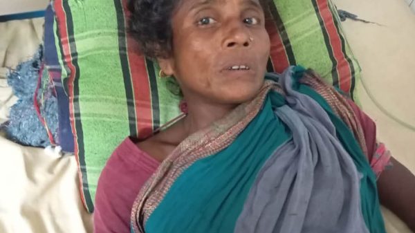 সাপে কাটার পর ঘরোয়া চিকিৎসা নয়, সময়মতো হাসপাতালে গিয়ে প্রাণ বাঁচান—চিকিৎসকের পরামর্শ